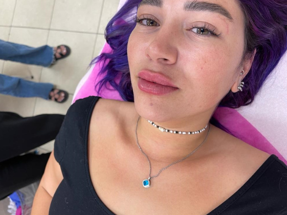 26