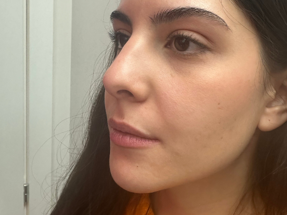 27