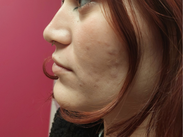 30
